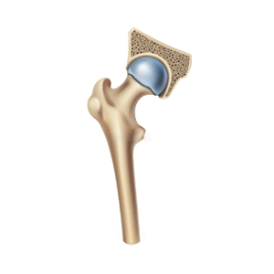 Bone, Joint & Physiotherapy Care